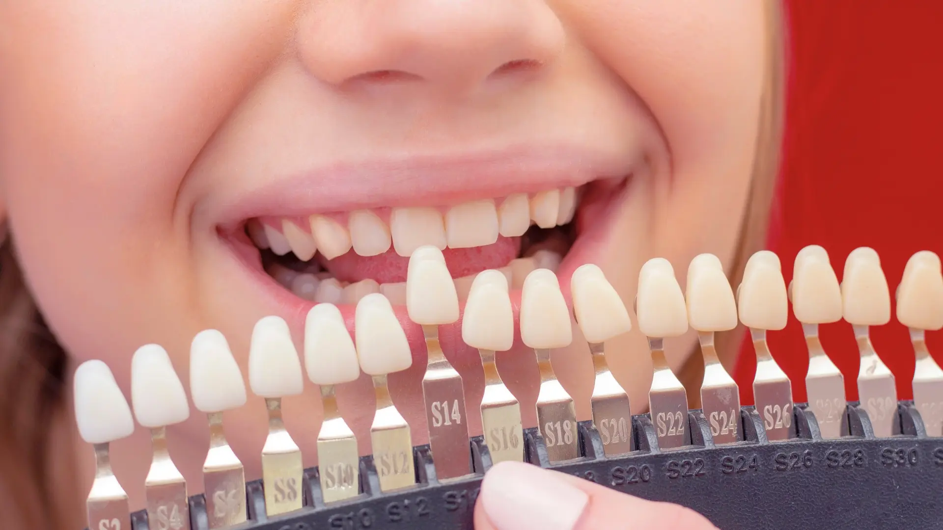 e-max dental crown treatment